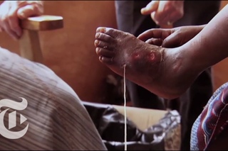 The Guinea Worm Slayer - 2013