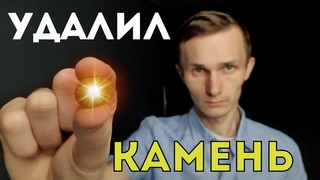 СПАСТИ ЖЕЛЧНЫЙ ПУЗЫРЬ  Удалить камни и сохранить орган