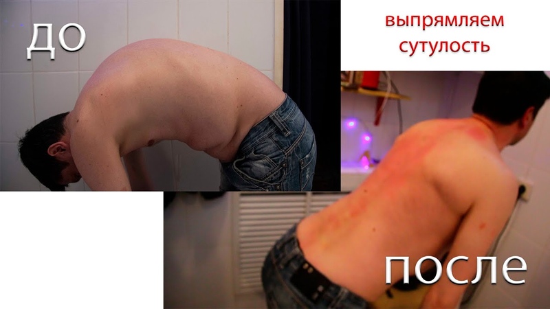 Правильная спина. Полностью не выпрямленный. Полностью не выпрямленный. Изометрические упражнения для колена. Полностью не выпрямленный.